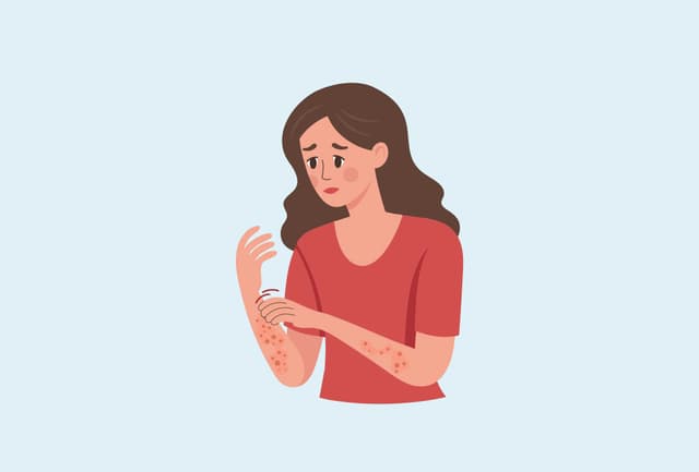 Am I At Risk Of Fungal Infection?
