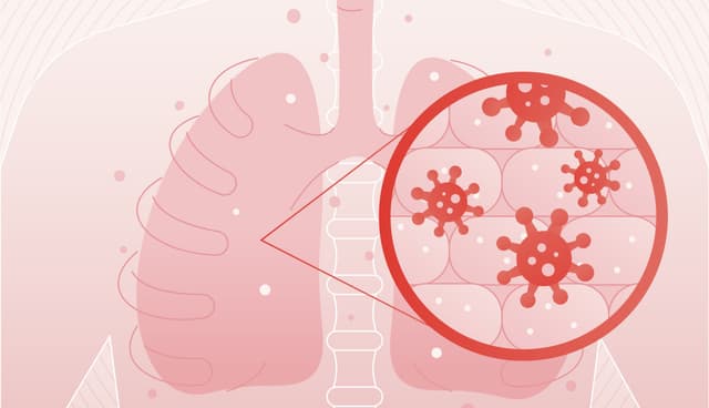 Am I At The Risk Of Bronchitis?