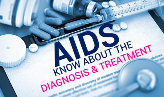 AIDS - Know about the Diagnosis & Treatment