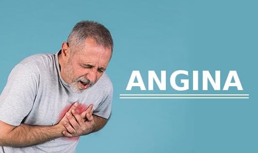 Angina