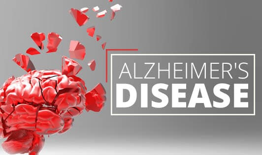 Alzheimer's Disease: The Memory Destroyer