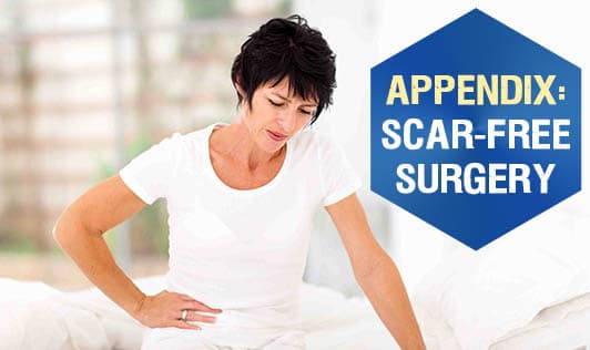Appendix: Scar-free surgery!
