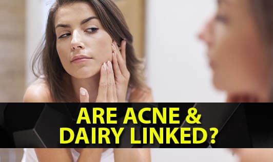 Are Acne & Dairy Linked?