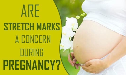 Are Stretch Marks A Concern During Pregnancy?