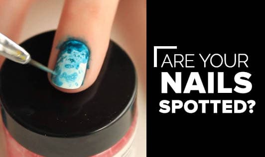 Are your Nails Spotted?