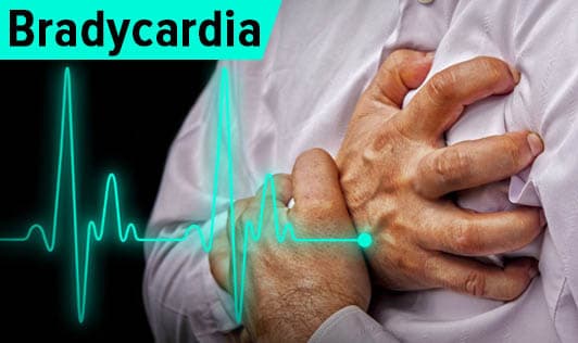 Bradycardia