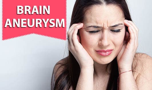 Brain Aneurysm