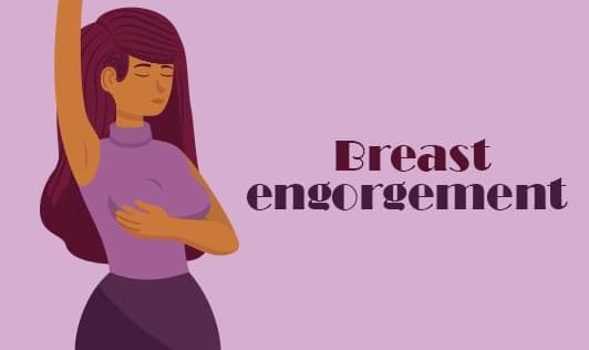 Breast engorgement (Full, Sore Breasts)