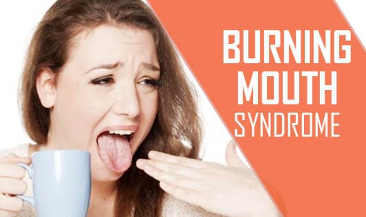Burning Mouth Syndrome