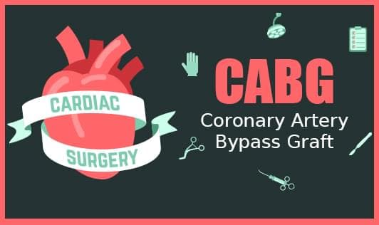 CABG (Coronary Artery Bypass Graft)