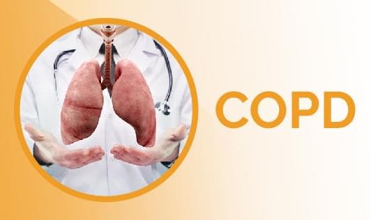 Chronic Obstructive Pulmonary Disease (COPD): Symptoms, Treatment & More