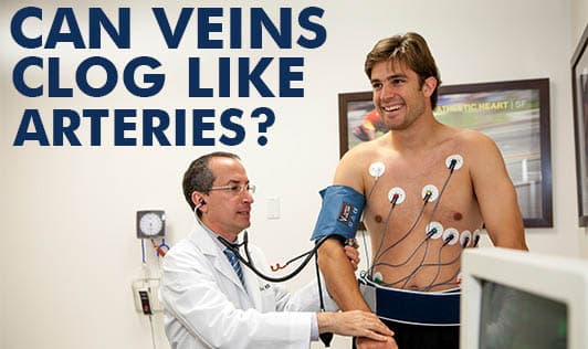 Can Veins Clog Like Arteries?