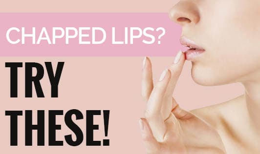 Chapped Lips? Try These!