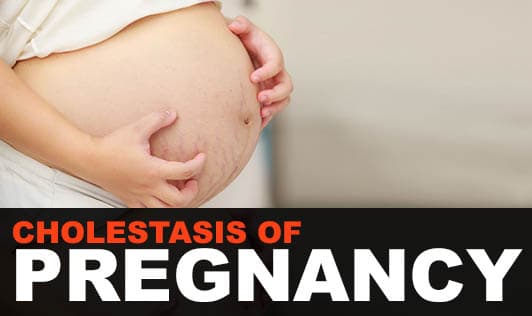 Cholestasis of Pregnancy