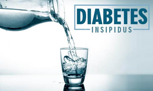 Diabetes Insipidus