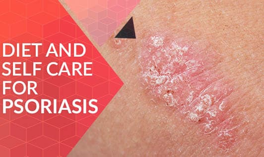 Diet and Self Care for Psoriasis