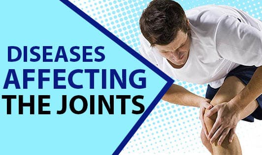 Diseases Affecting the Joints