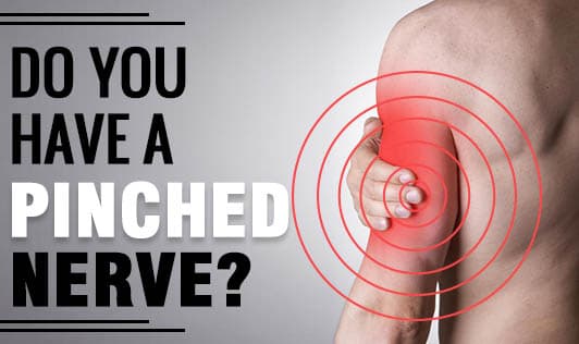 Do you have a pinched nerve?