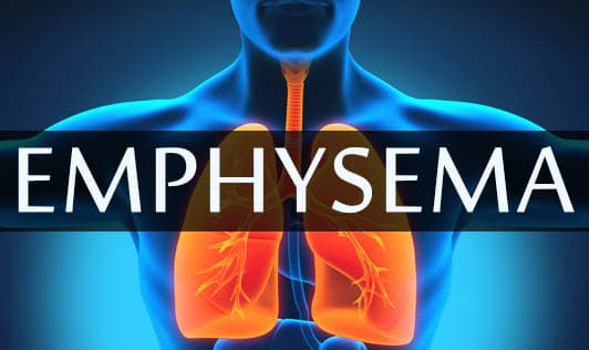 Emphysema