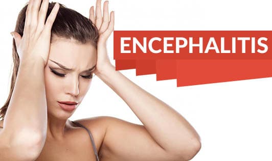 Encephalitis