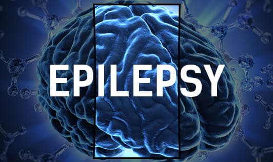 Epilepsy