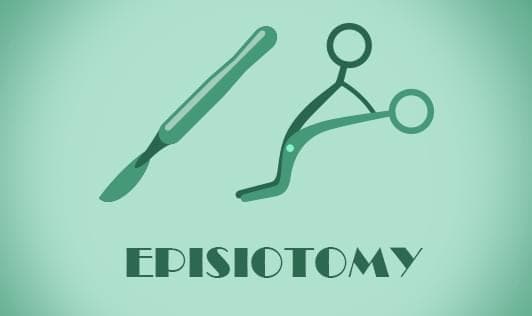 Episiotomy