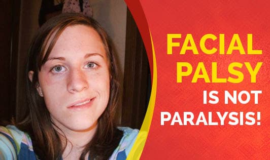 Facial Palsy is not Paralysis!