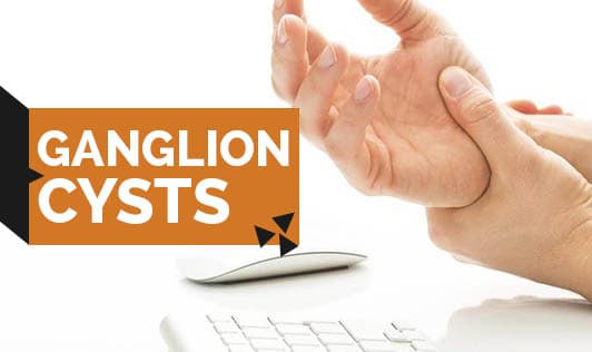 Ganglion Cysts