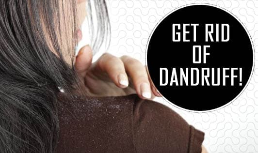 Get rid of dandruff!