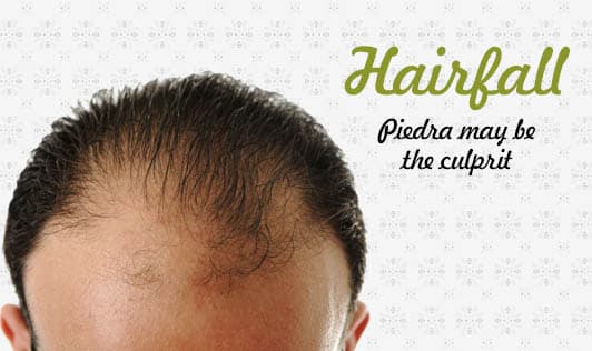 Hairfall? Piedra may be the culprit