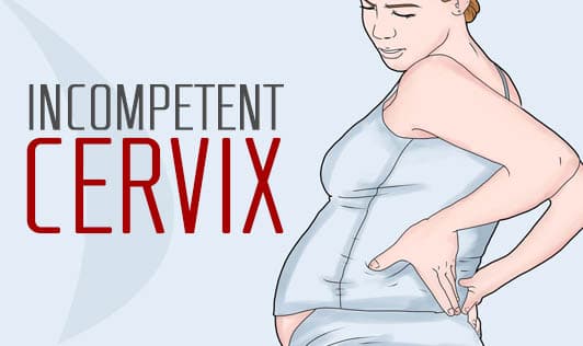 Incompetent Cervix