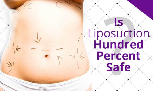 Is Liposuction Hundred Percent Safe?