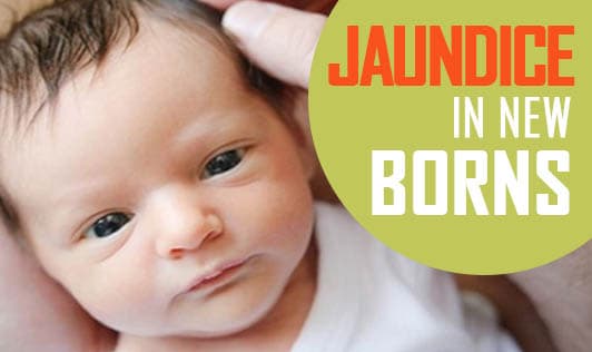 Jaundice in newborns!