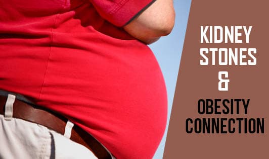 Kidney Stones & Obesity Connection