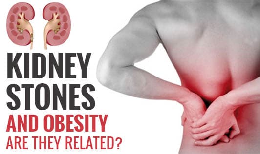 Kidney Stones and Obesity - Are they Related?