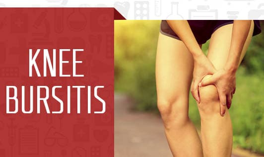 Knee bursitis