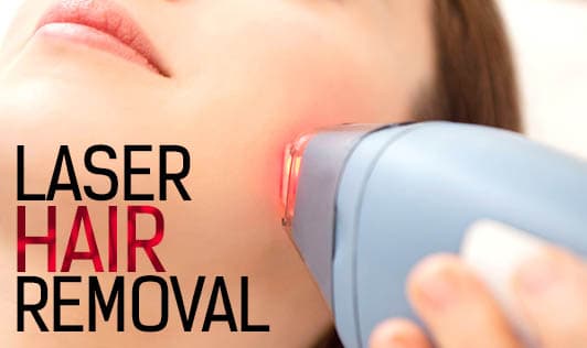 Laser Hair Removal