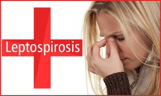 Leptospirosis