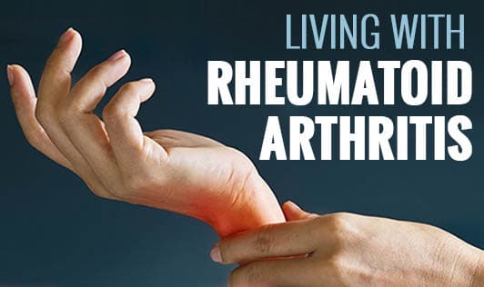 Living with Rheumatoid Arthritis 