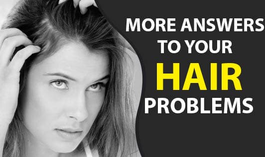 MORE ANSWERS TO YOUR HAIR PROBLEMS