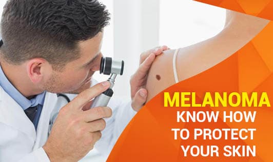Melanoma - Know How to Protect your Skin