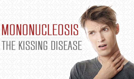 Mononucleosis - The kissing disease