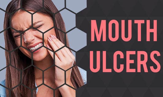 Mouth Ulcers