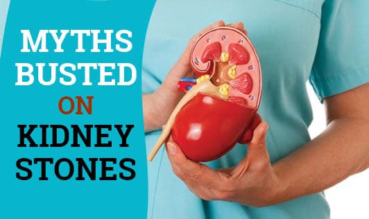Myths busted on Kidney Stones