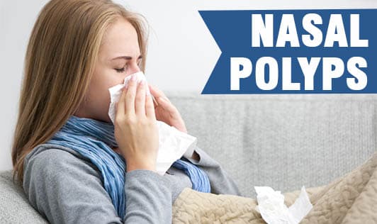 Nasal Polyps