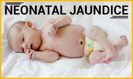 Neonatal Jaundice