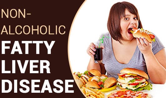 A Dangerous Disease is Silently Rising in India — Non-Alcoholic Fatty Liver Disease (NAFLD)