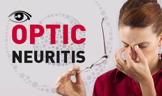 Optic Neuritis