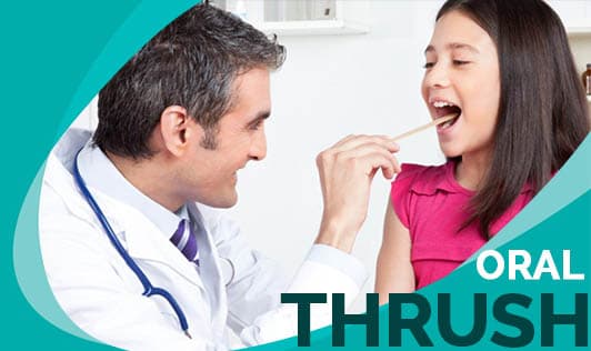 Oral Thrush: Causes, Symptoms, Risk Factors, and Prevention