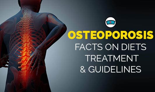 Osteoporosis: Facts on Diets, Treatment, & Guidelines